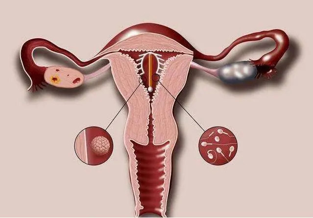 为什么多囊卵巢患者降调两个月后基础卵泡变少了呢